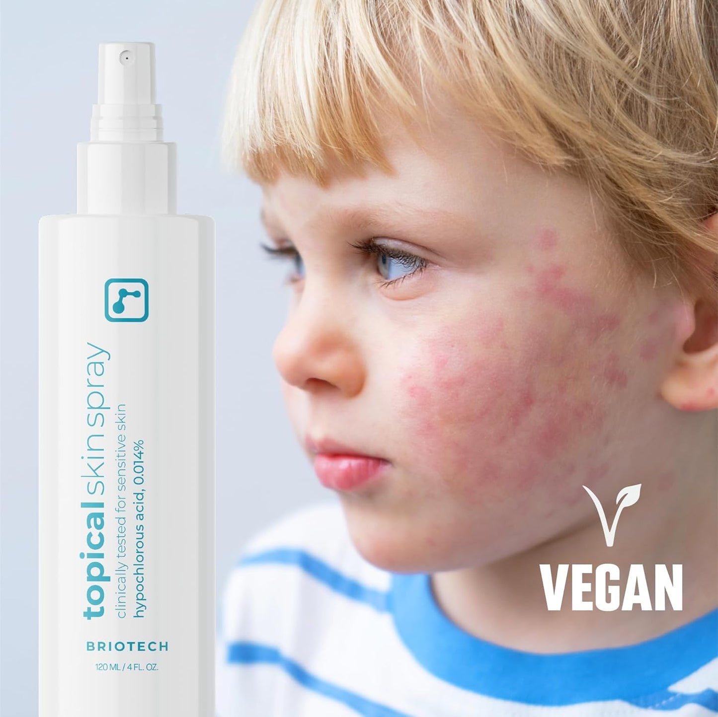 Briotech Topical Skin Spray 8 Fl Oz 240 ML